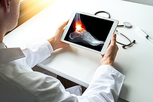 The Severity of Ankle Fractures